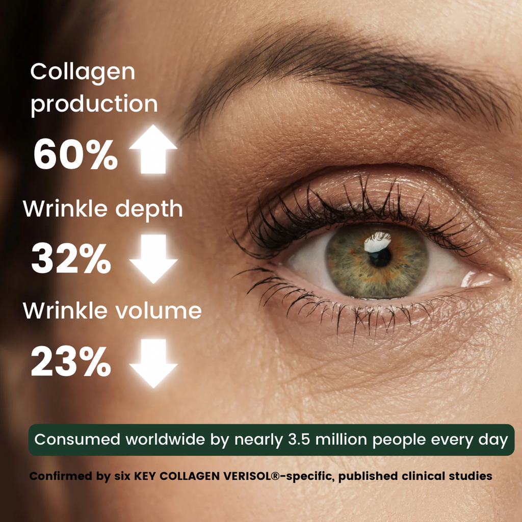 Close-up of woman’s eye showing reduced wrinkle depth and improved collagen production from VERISOL collagen peptides clinical study results