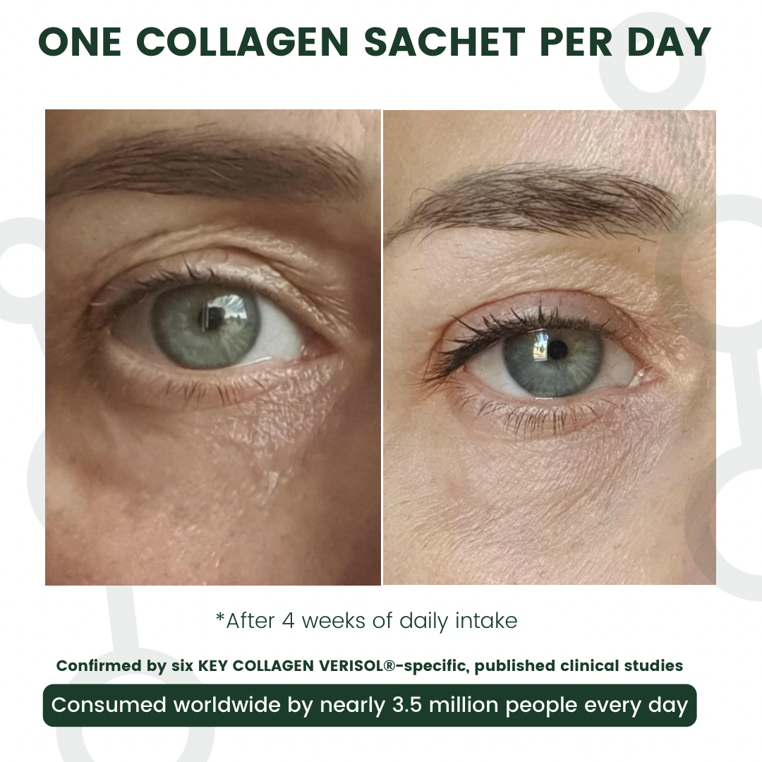 Visible difference, before and after of 4 weeks after daily use - Eye Focus