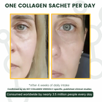 Visible difference, before and after of 4 weeks after daily use - Cheek Focus