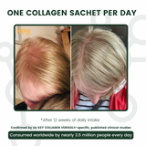 Visible difference, before and after of 4 weeks after daily use - Hair Focus