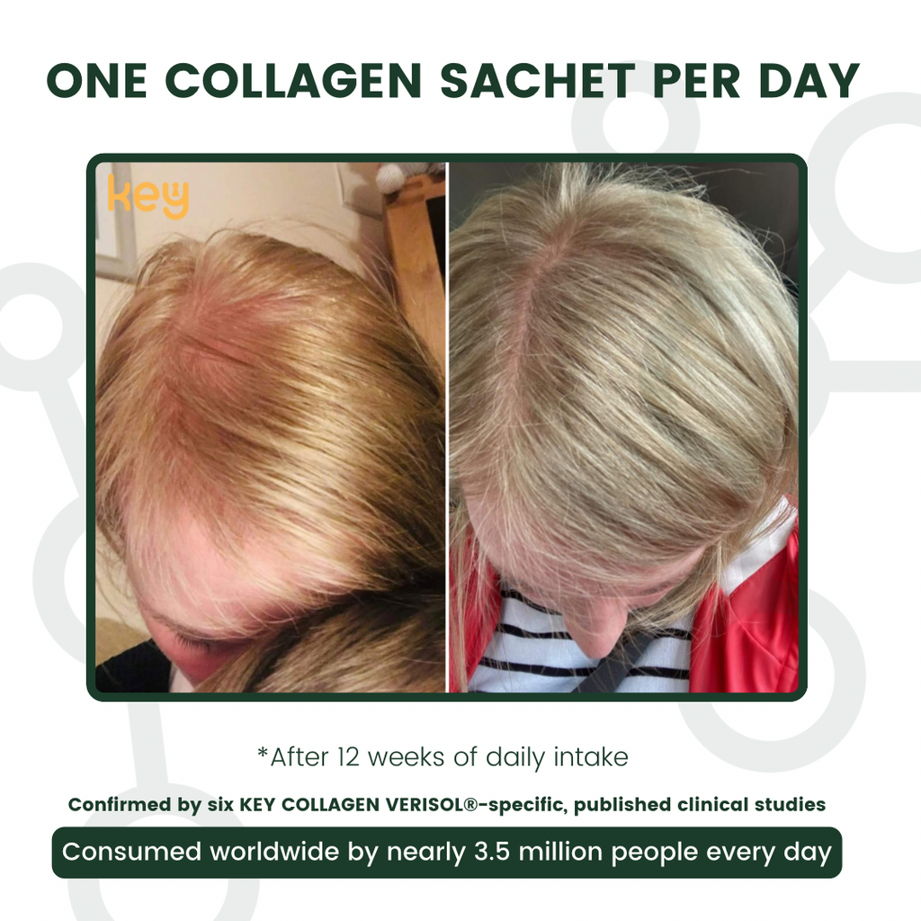 Visible difference, before and after of 4 weeks after daily use - Hair Focus