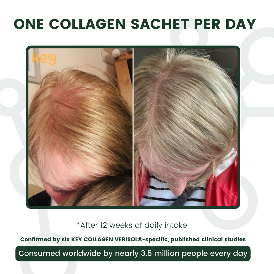 Visible difference, before and after of 4 weeks after daily use - Hair Focus