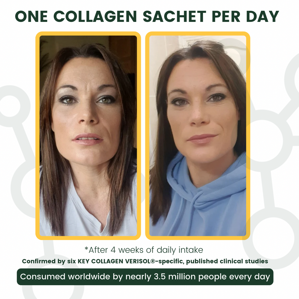 Visible difference, before and after of 4 weeks after daily use - Overall Face Focus