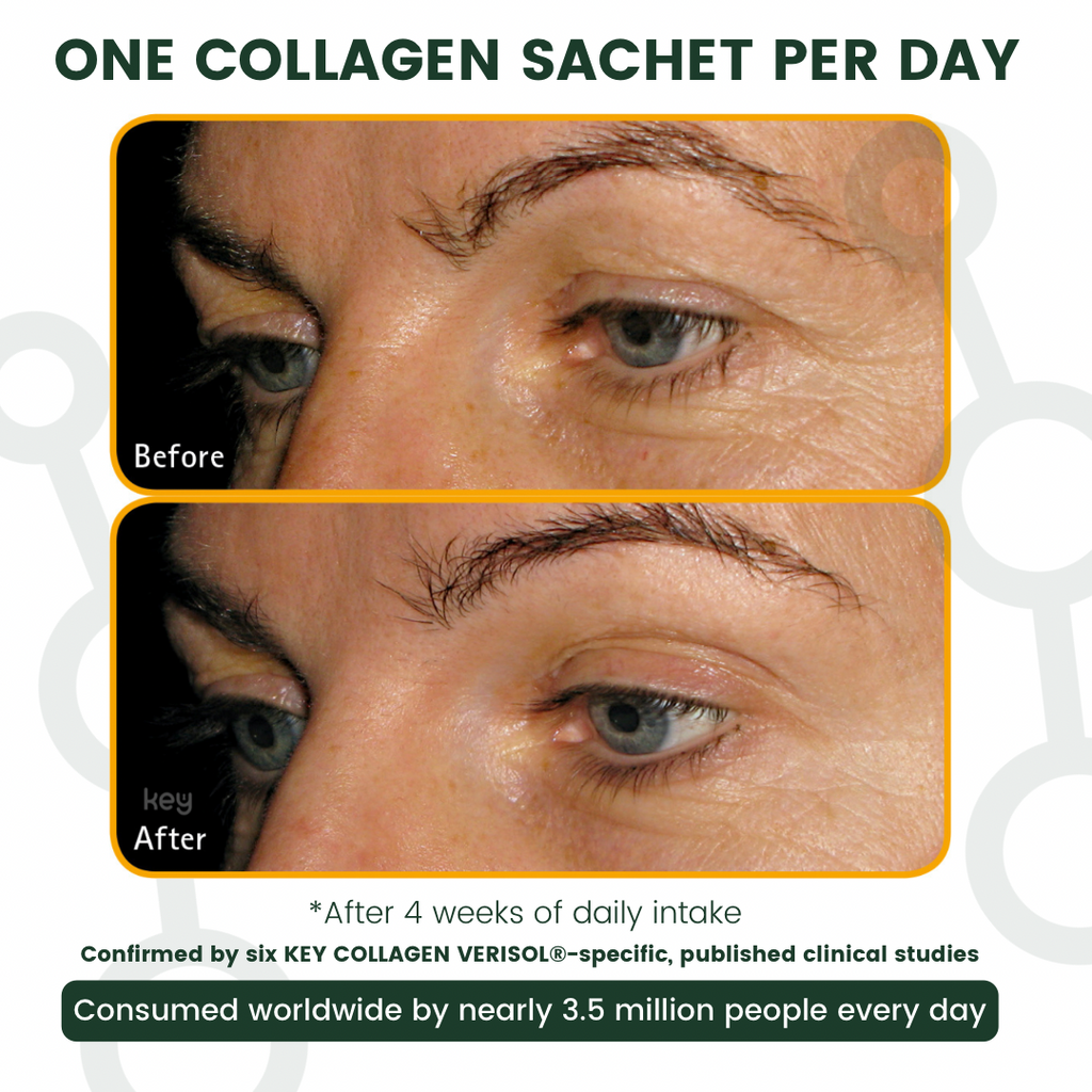 Visible difference, before and after of 4 weeks after daily use - Skin Focus