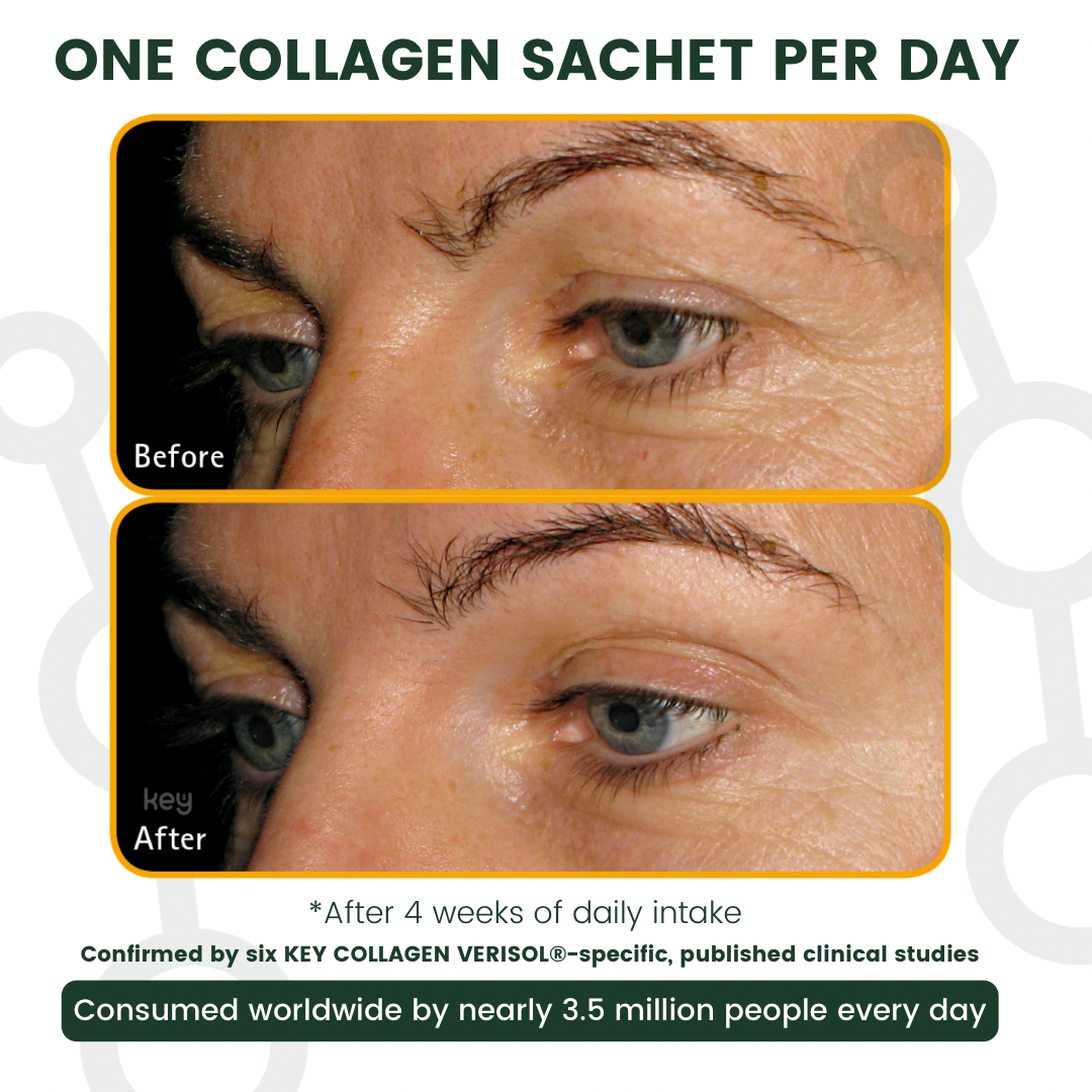 Visible difference, before and after of 4 weeks after daily use - Skin Focus