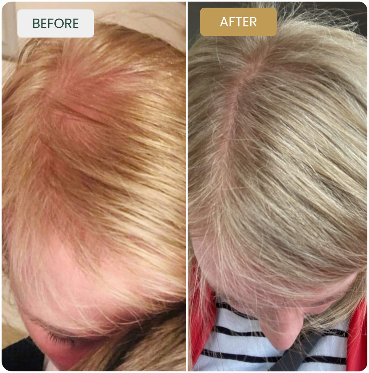 Such A Difference After 1 Month