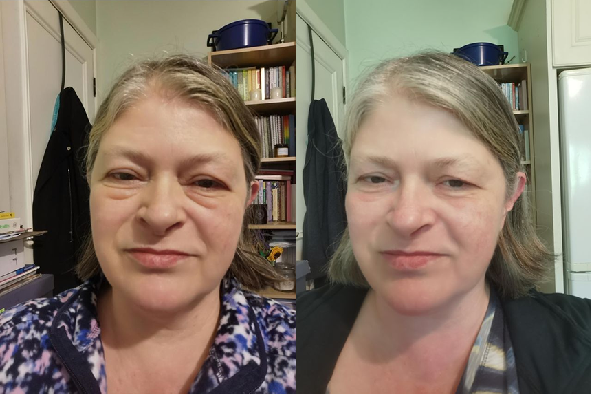 Helps lines around the eyes